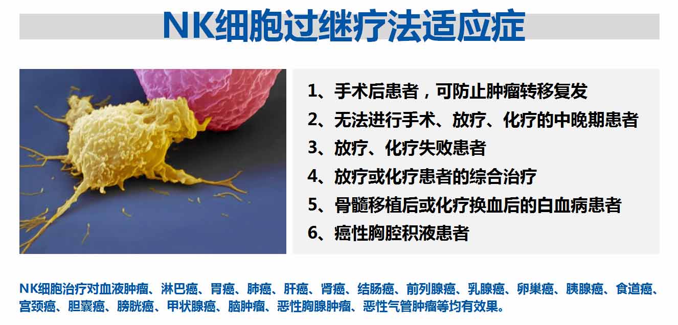 NK細胞過繼療法適應(yīng)癥