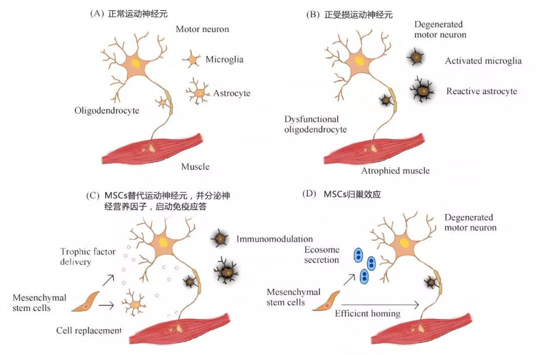 干細胞療法調理ALS作用機制