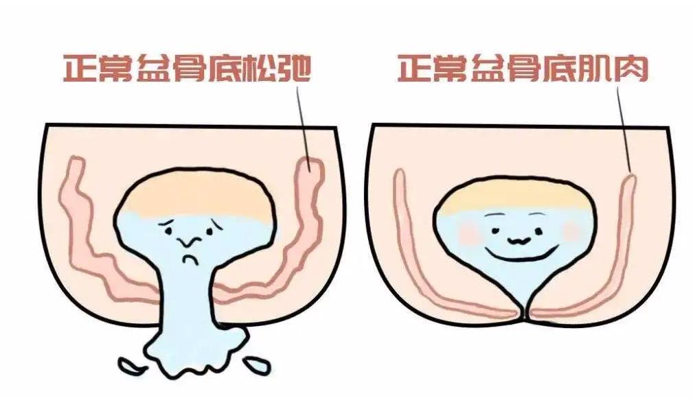 干細(xì)胞在女性盆底肌障礙性疾病中的研究