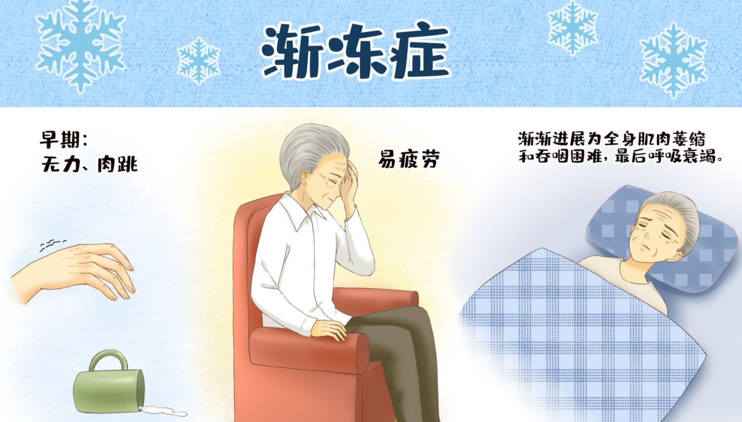 157例研究數(shù)據(jù)表明，干細胞治療能明顯延長漸凍癥生存期