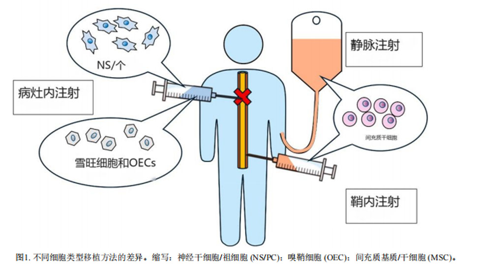 干細(xì)胞治療脊髓損傷