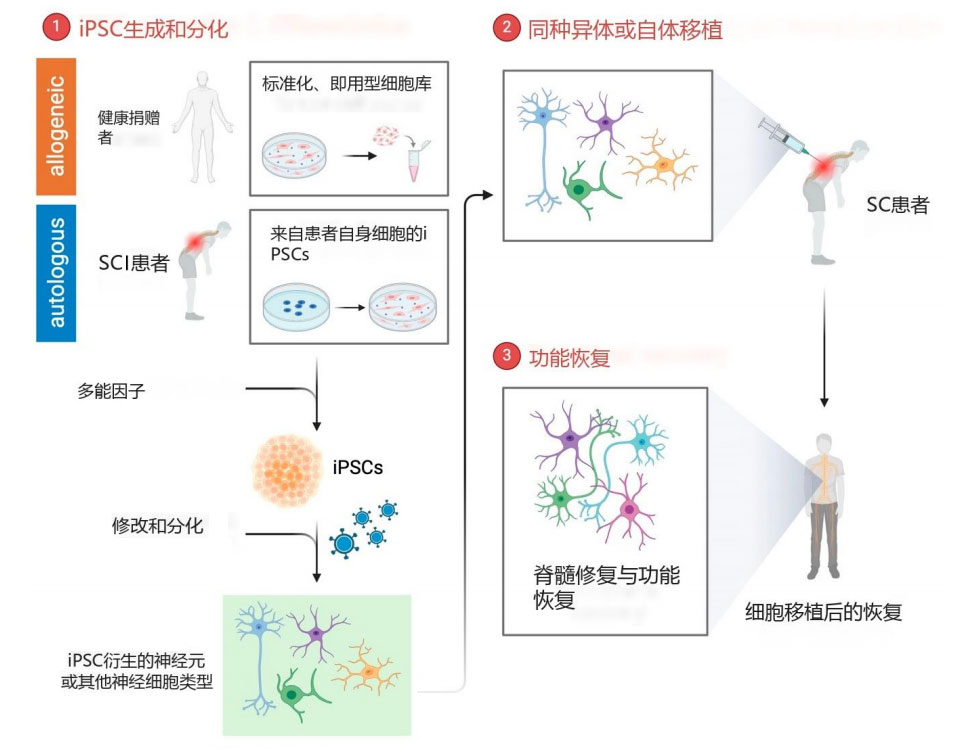 脊髓損傷臨床試驗