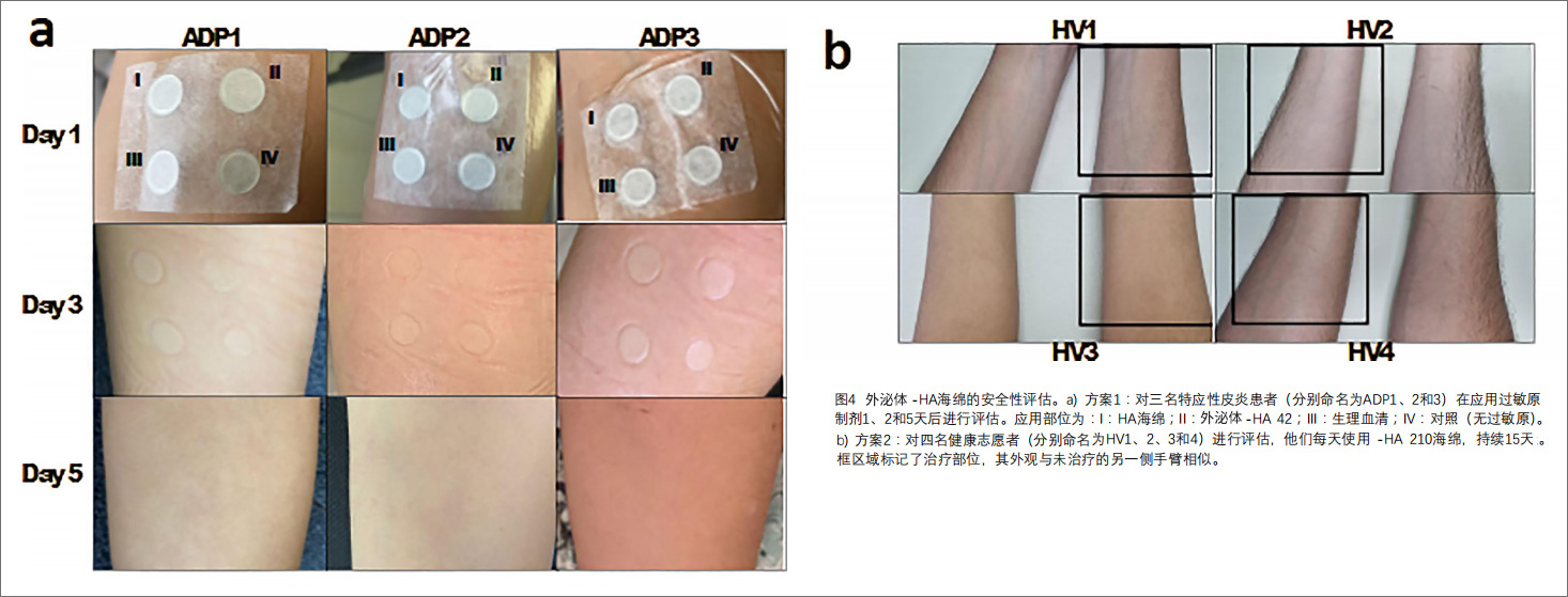 銀屑病臨床試驗(yàn)