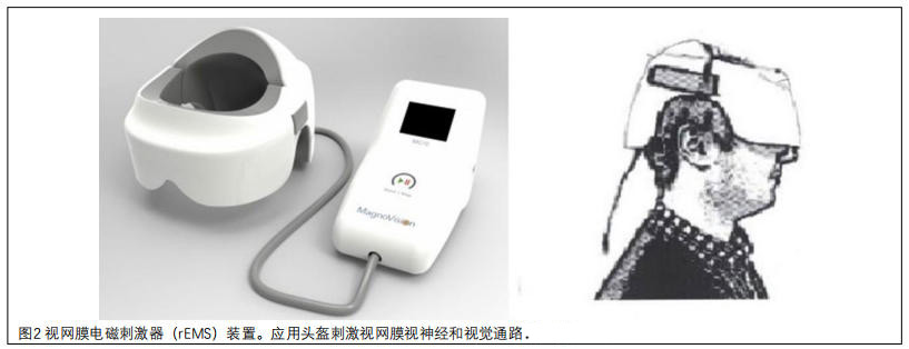 中毒性視神經(jīng)病變臨床試驗