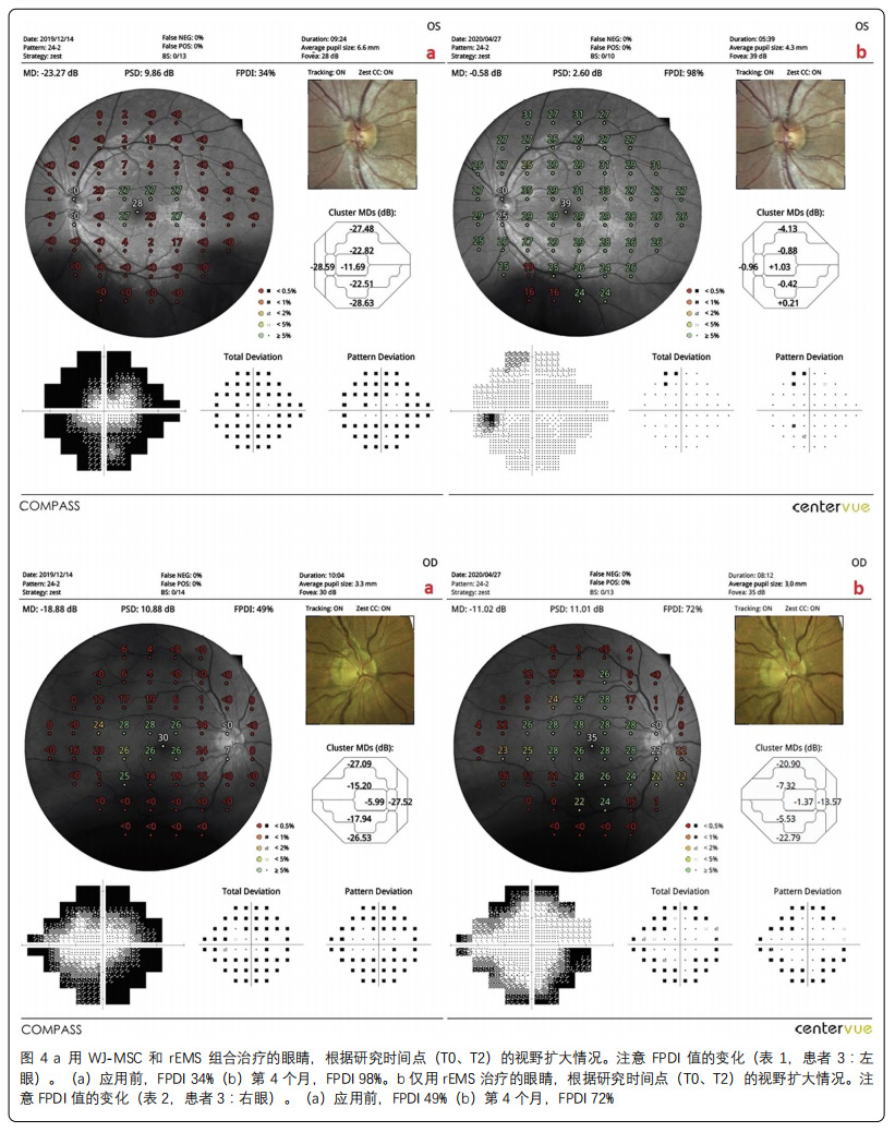 中毒性視神經(jīng)病變臨床試驗