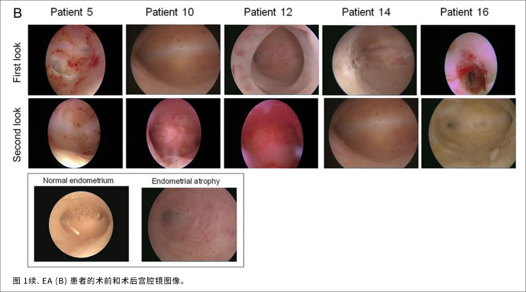 宮腔疾病臨床試驗