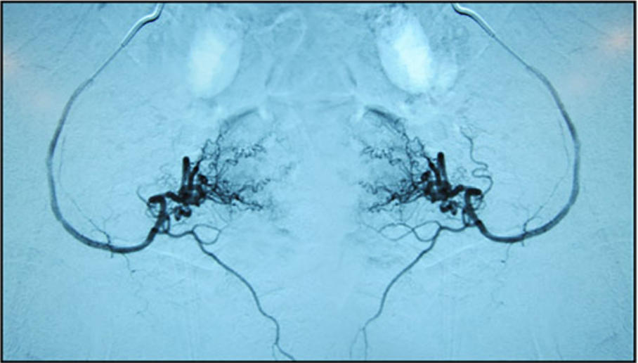 宮腔疾病臨床試驗