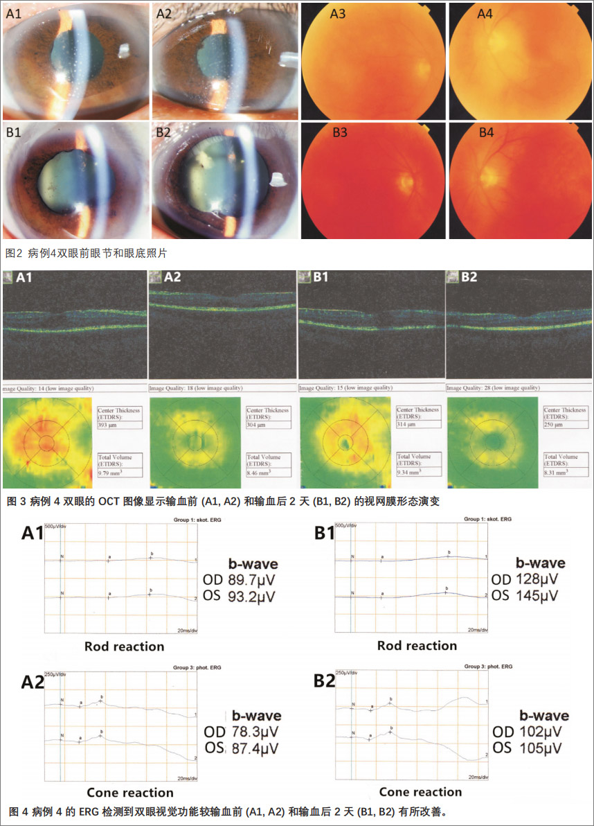 葡萄膜炎臨床試驗